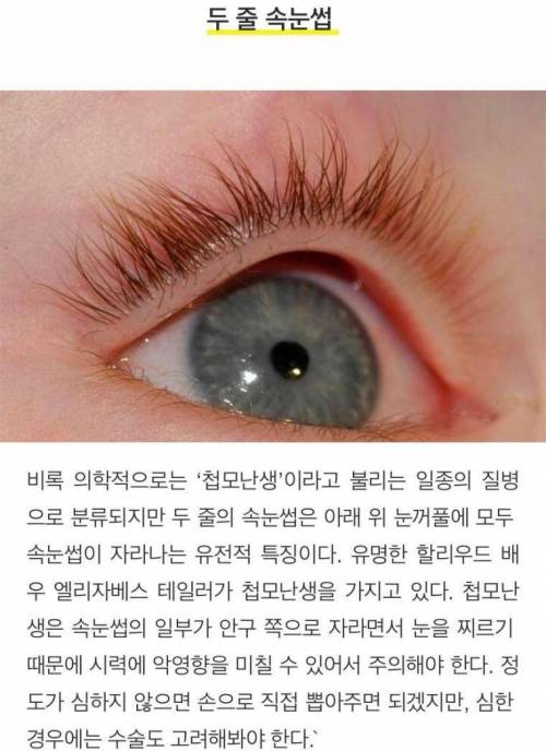 [스압] 희귀하고 독특한 신체특징 10가지.jpg