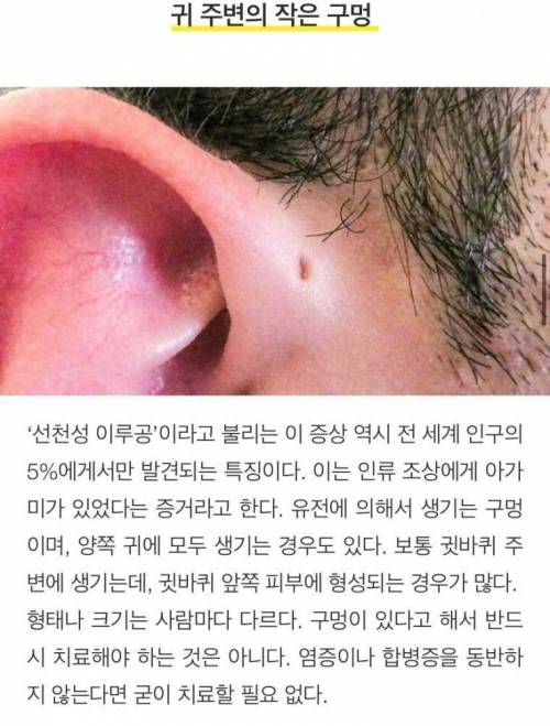 [스압] 희귀하고 독특한 신체특징 10가지.jpg