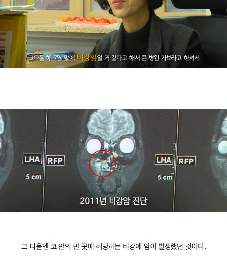 [스압] 치명적 가족력.jpg