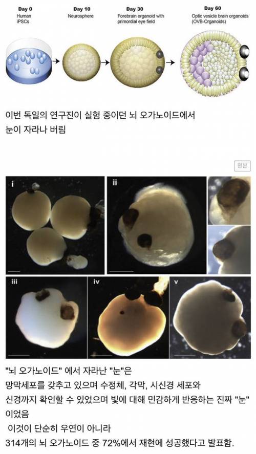 "인공뇌" 에서 스스로 "눈"이 자라나버린 생물학계 놀라운 사건.jpg