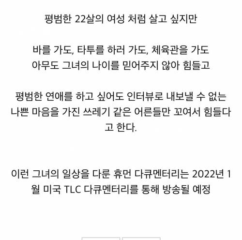 희귀병으로 8살 때 성장이 멈춰버린 22살 미국인