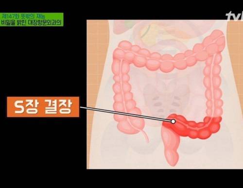 옷 벗고 똥싸고 옷 입는 시간까지 3분안에 마쳐야 하는 이유