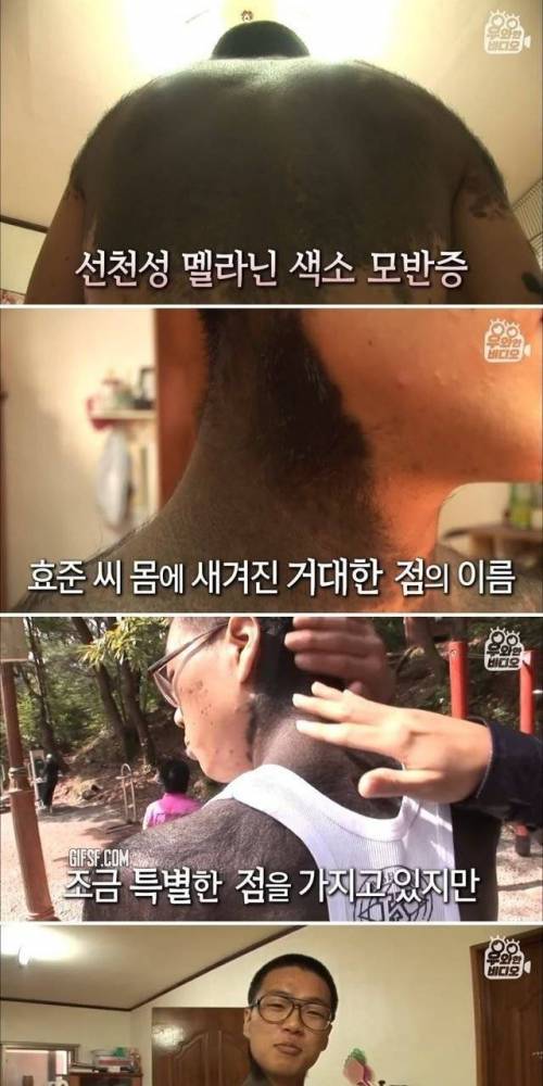 목 부터 다리까지 이어지는 점을 가진 남자, 12년 후 근황