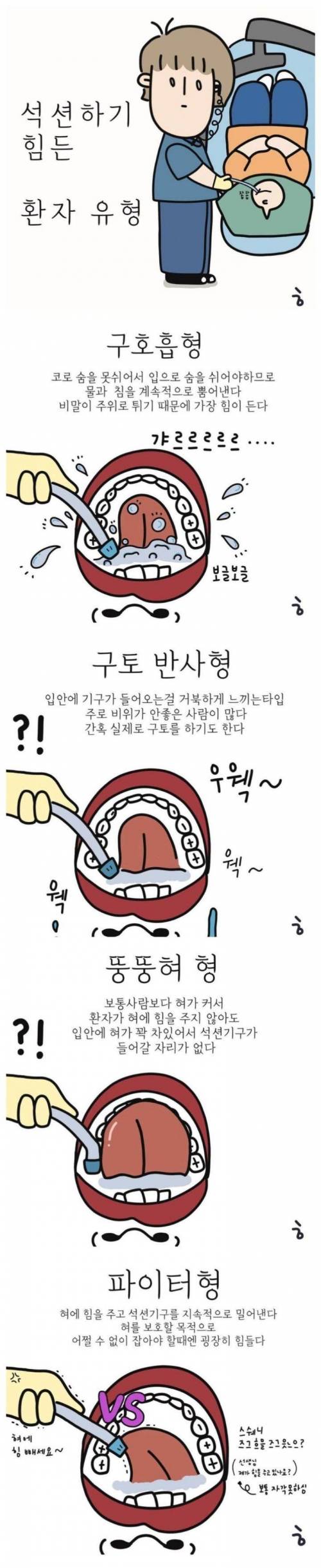 치과에서 석션하기 힘들다는 환자 유형