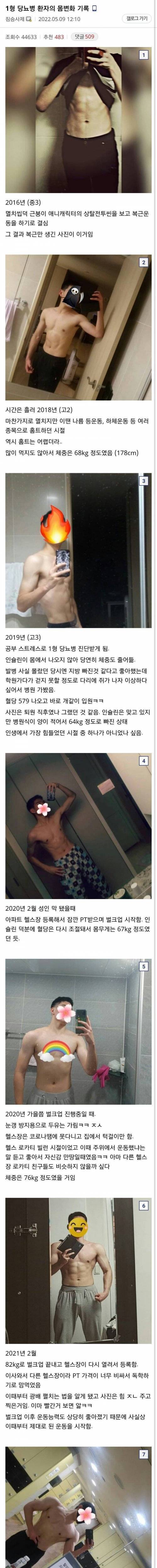 1형 당뇨병 환자의 발병 후 신체변화