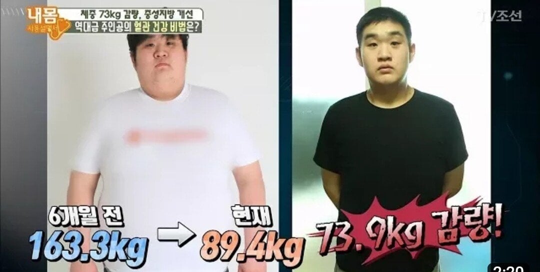 다이어트 80kg 감량 성공했던 사람 근황...jpg