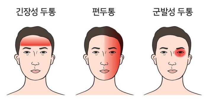 오싹오싹 현존하는 최악의 두통