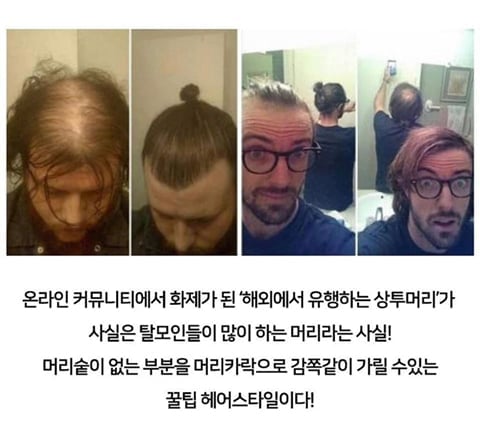 백인들이 상투머리 많이 하는 이유