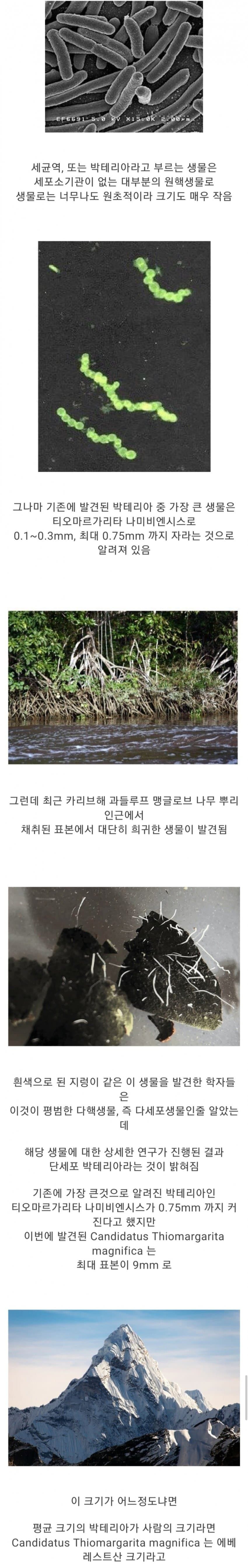 믿기 어려울 정도로 거대한 세균 발견.