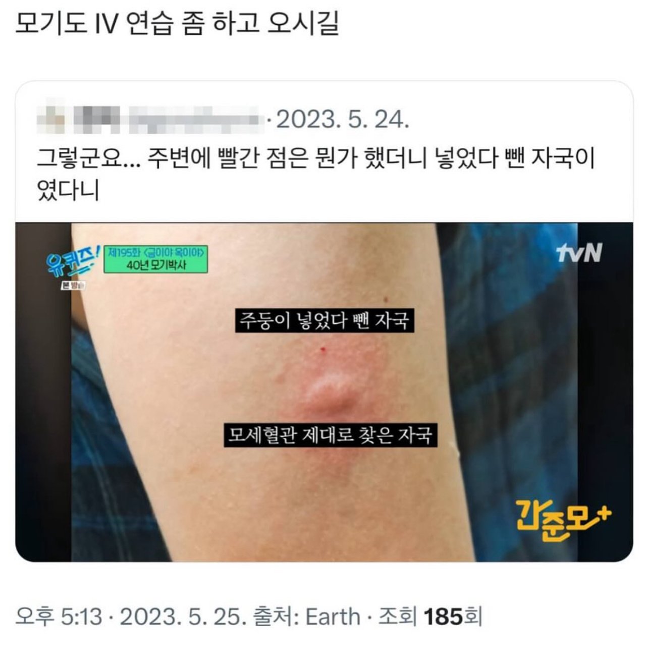 모기 물린 자국 옆 빨간 점은 무엇일까?