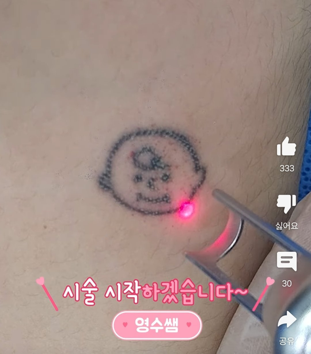 하찮은 문신 지우러 온 사람들