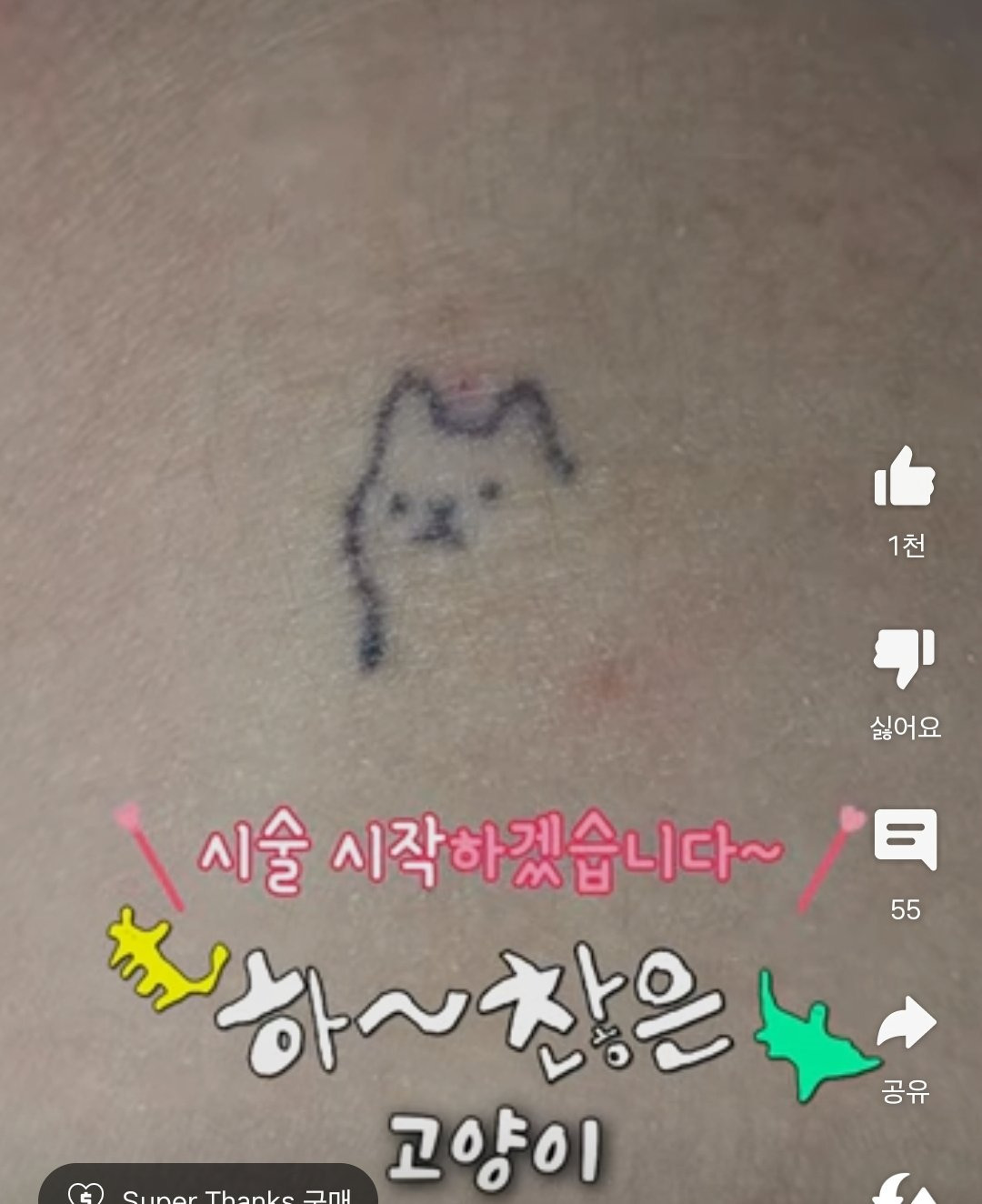 하찮은 문신 지우러 온 사람들