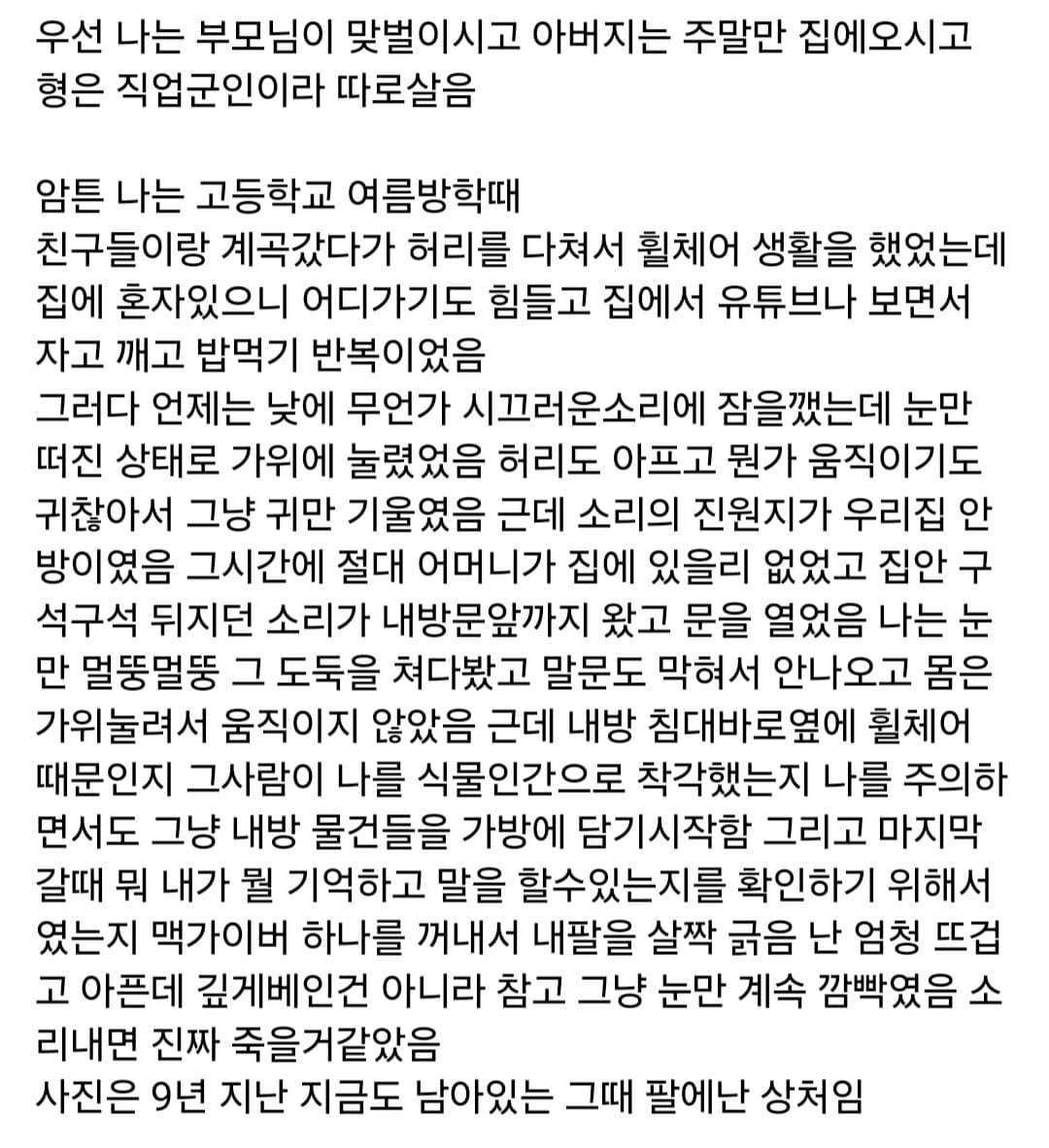 식물인간인 척해서 살은 사람