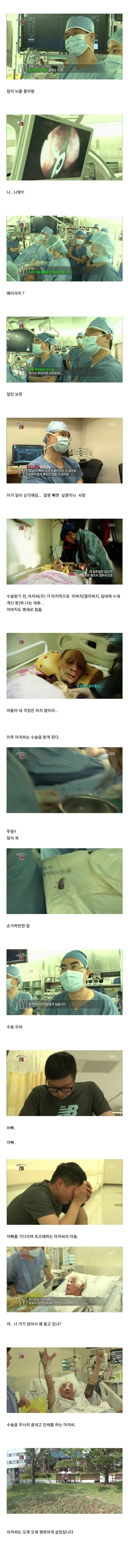 머리에 꽂힌 8cm 칼 빼내는 수술.jpg