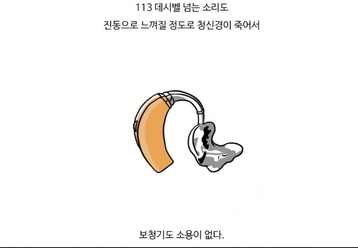 청각장애인들은 꿈에서도 안 들릴까?