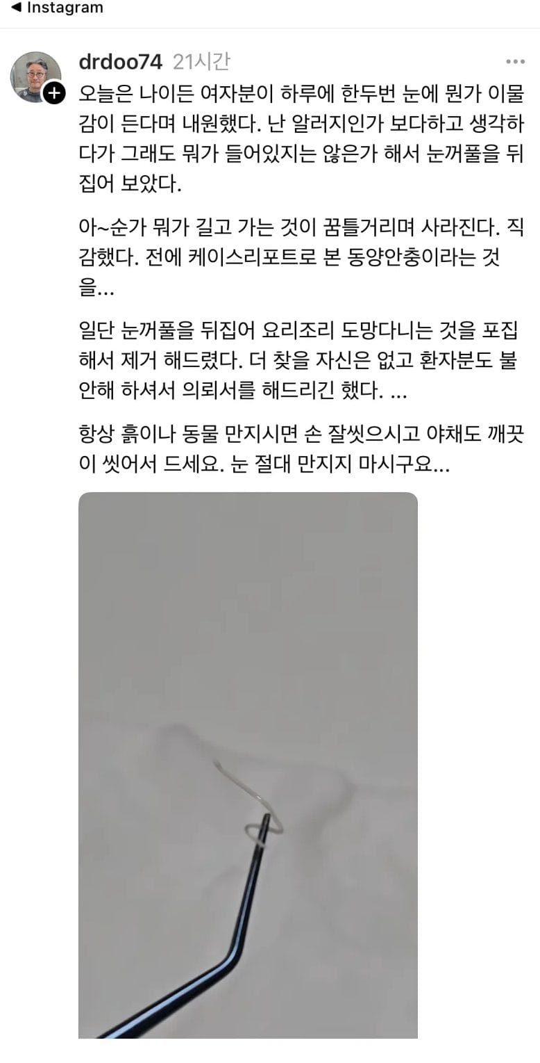 혐주의] 눈에 뭔가 이물감이 들어요.jpg