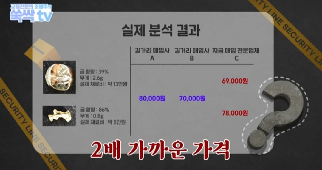 치과 치료후 나온 금이빨을 길거리 매입업체에 팔면 안되는 이유