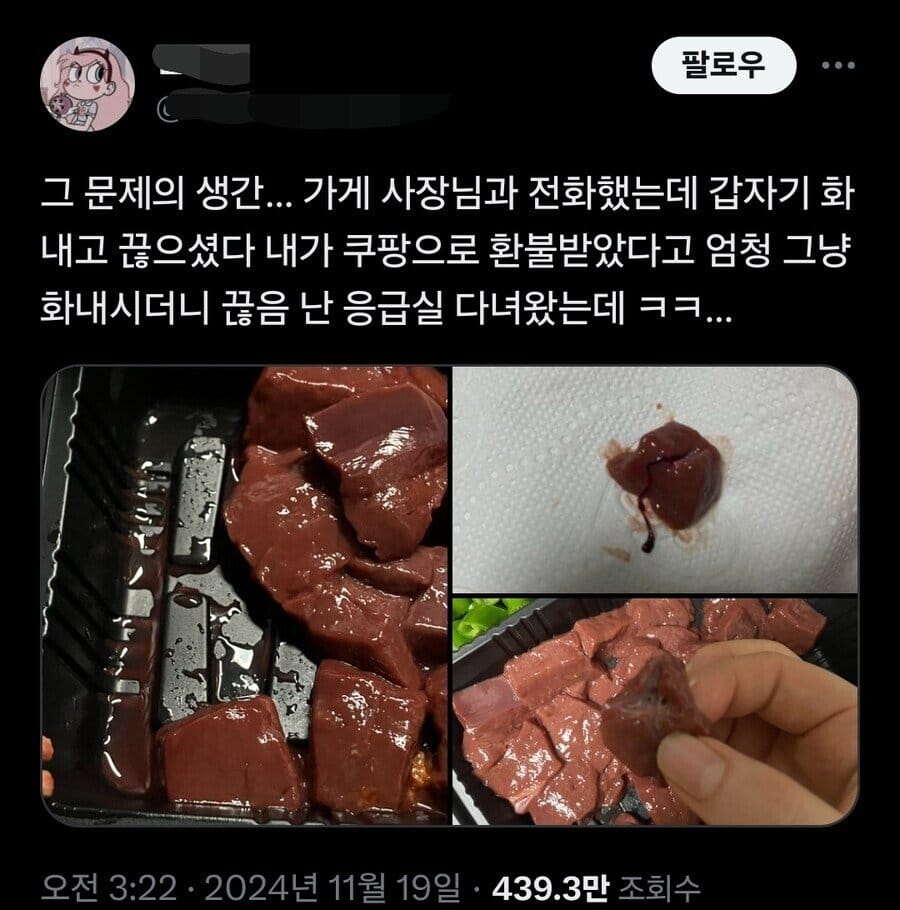 배달 생간 먹고 응급실 간 사람