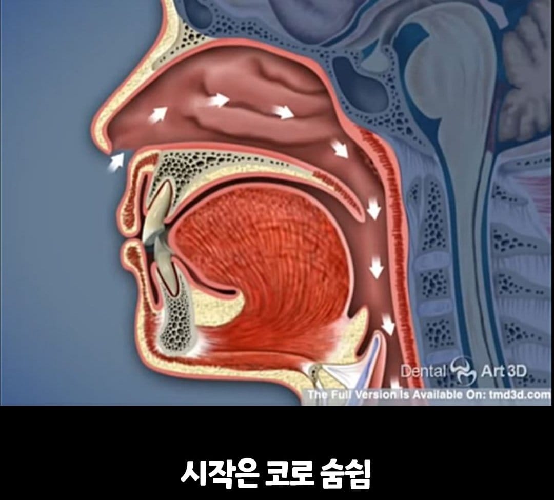 비염의 무서움 ㅎㄷㄷ