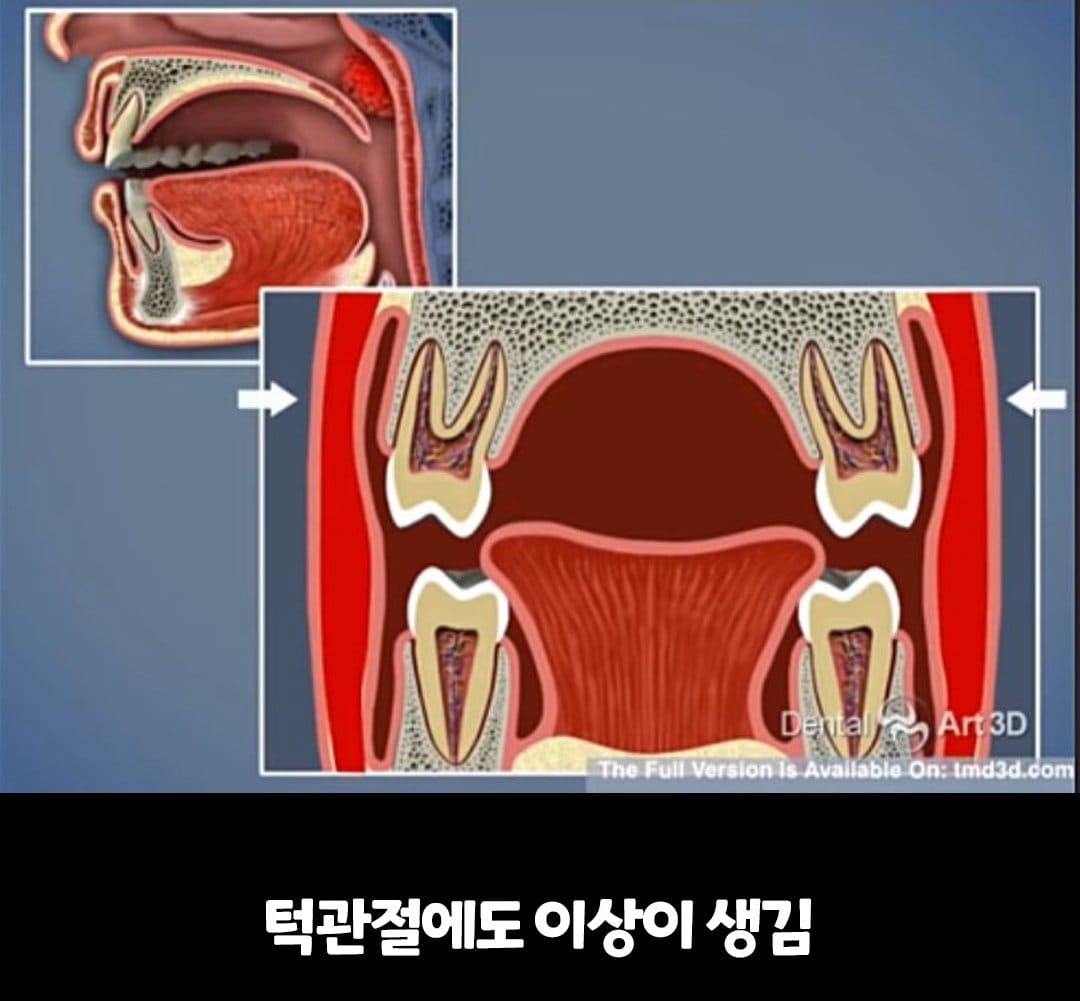 비염의 무서움 ㅎㄷㄷ