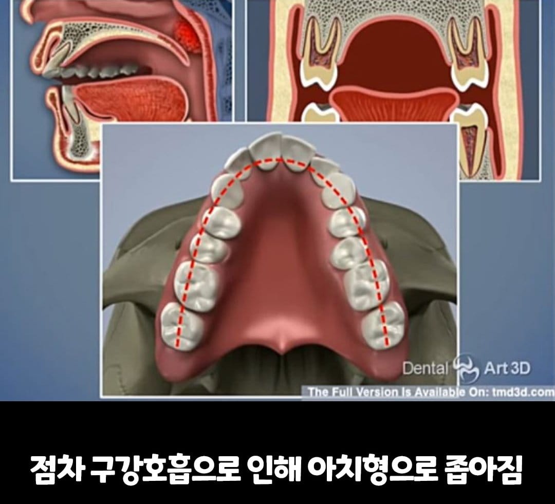 비염의 무서움 ㅎㄷㄷ