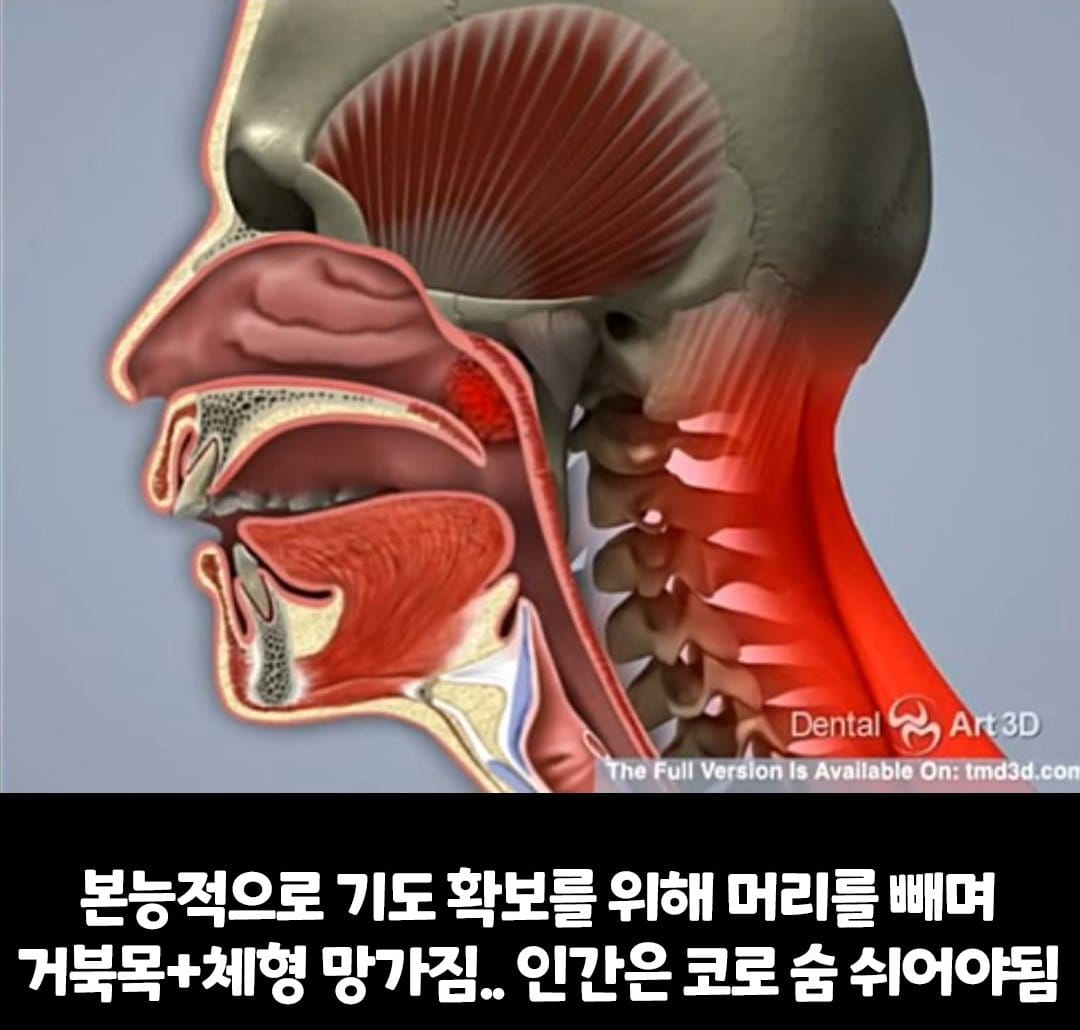 비염의 무서움 ㅎㄷㄷ