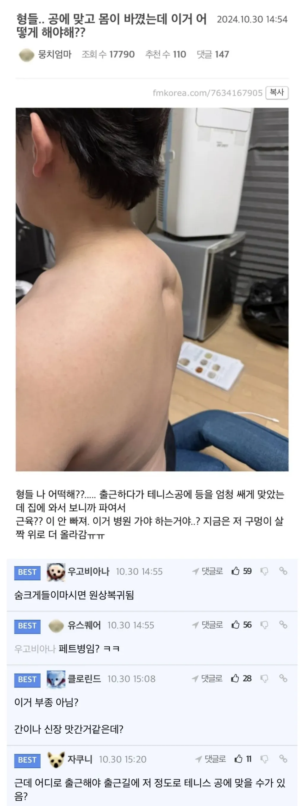 형들.. 공에 맞고 몸이 바꼈는데 이거 어떻게 해야해