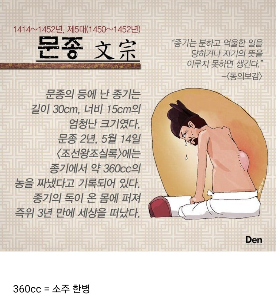 조선 문종의 등에 난 종기 수준