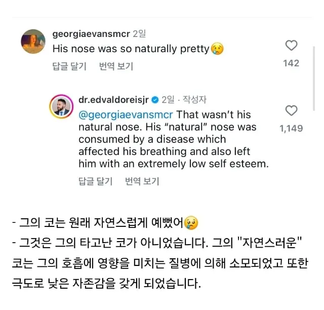 인스타에서 화제된 해외 코성형 전후.jpg