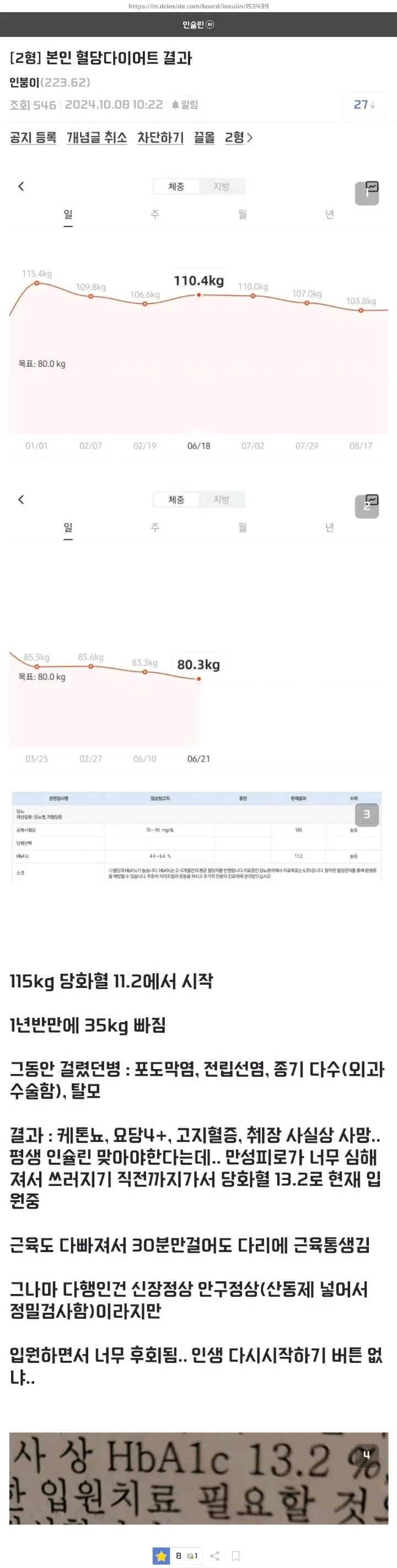 절대 하면 안되는 당뇨 다이어트를 한 사람 ㄷㄷ