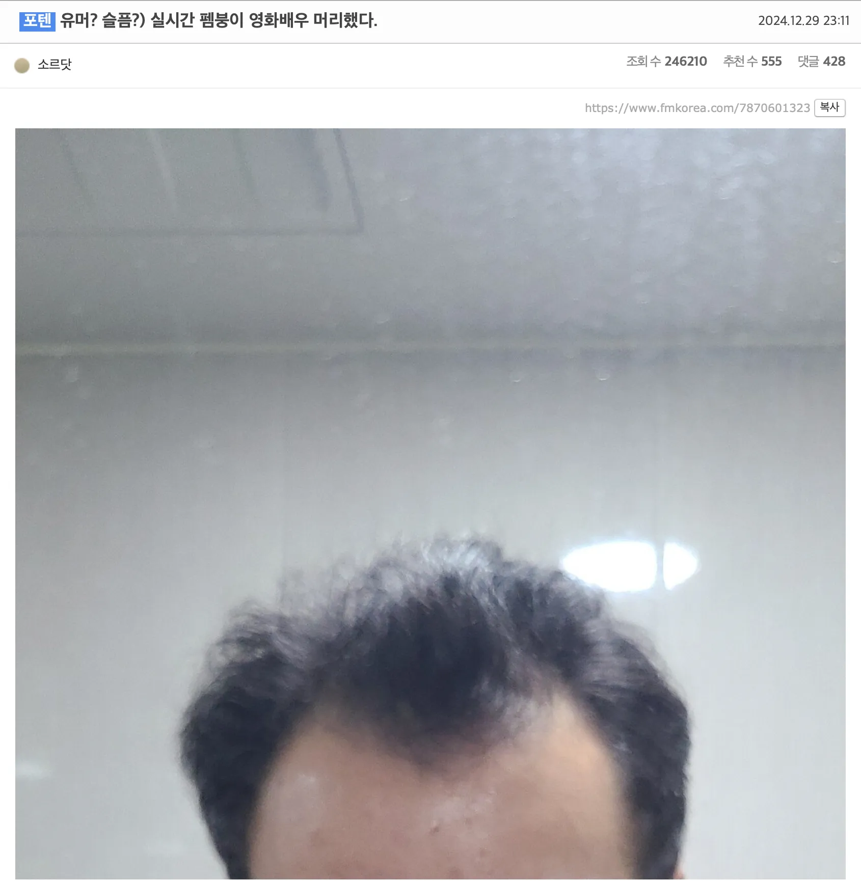 어느 펨붕이의 탈모약 2달 복용 후기